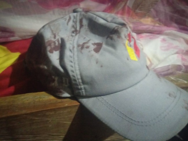 Kenakan Atribut Bawaslu PKD Weseben Dikeroyok Hingga Luka Jahitan. (Foto_red)