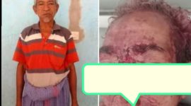 Korban Pembunuhan di Desa Weoe Kecamatan Wewiku. (Foto-Istimewa)