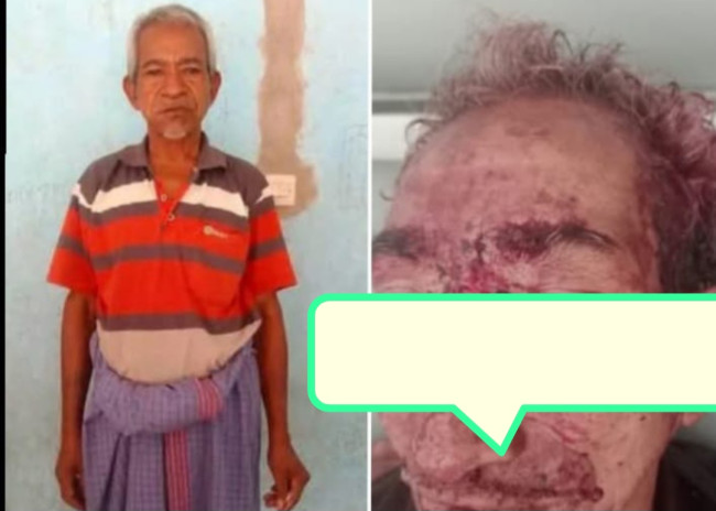 Korban Pembunuhan di Desa Weoe Kecamatan Wewiku. (Foto-Istimewa)